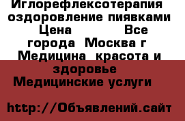 Иглорефлексотерапия, оздоровление пиявками › Цена ­ 3 000 - Все города, Москва г. Медицина, красота и здоровье » Медицинские услуги   